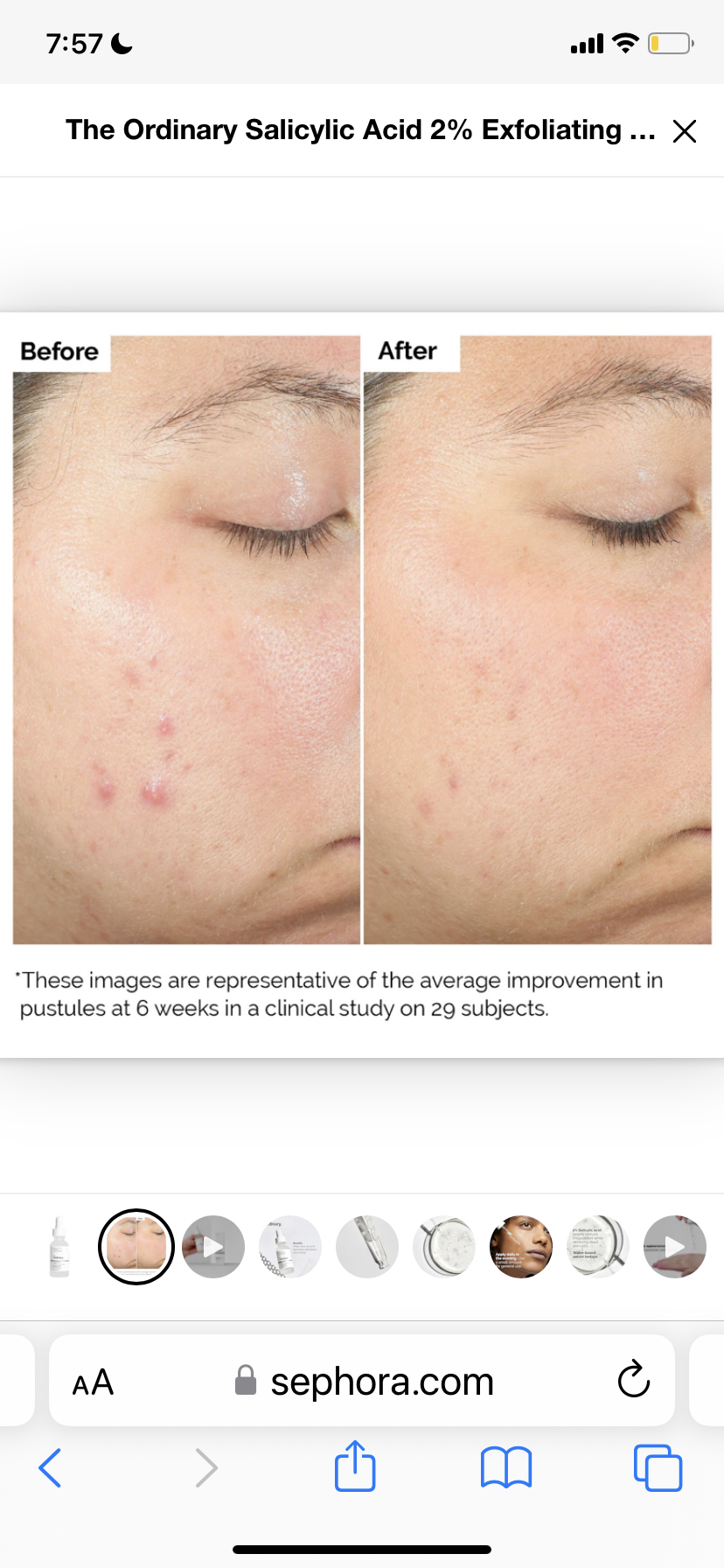 The Ordinary
Salicylic Acid 2% Exfoliating Blemish Solution